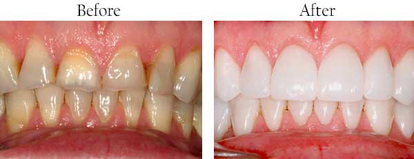 Paterson dental images