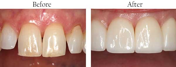 dental images 07501